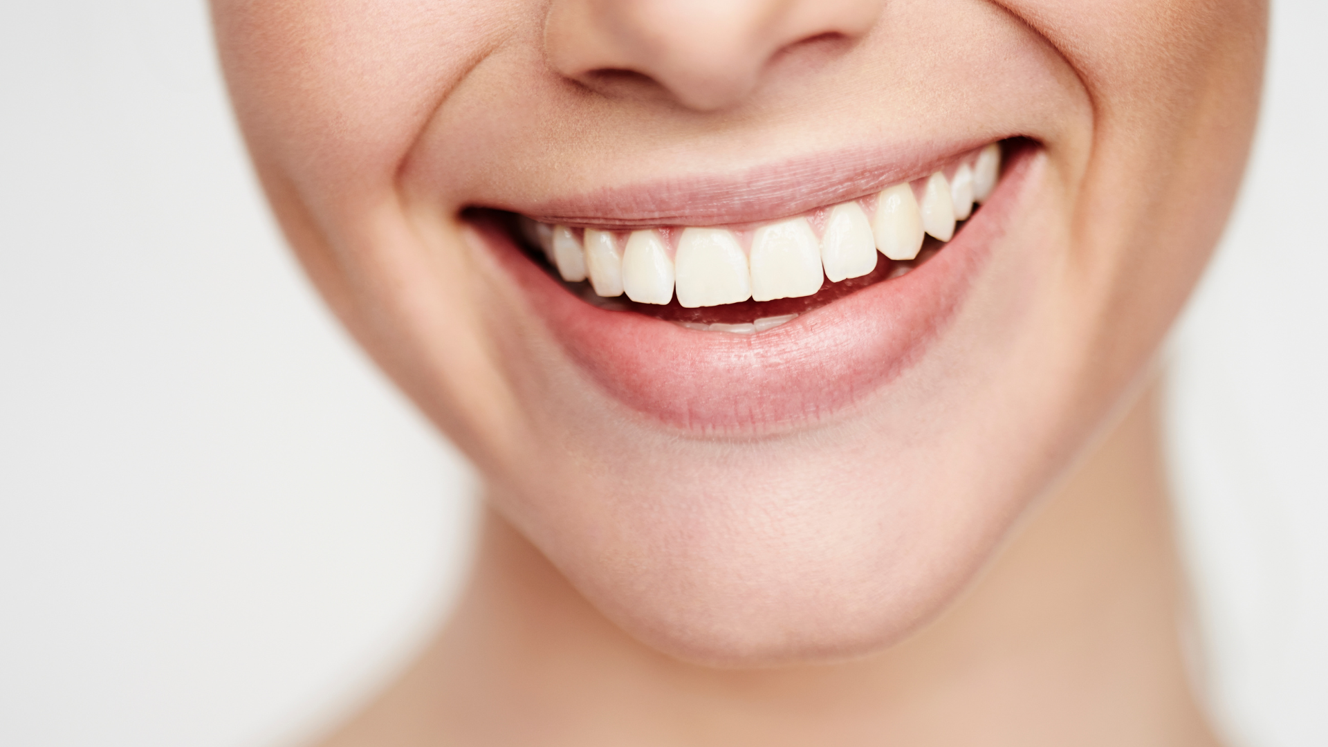Zdjęcie przedstawiające efekt po wybielaniu zębów